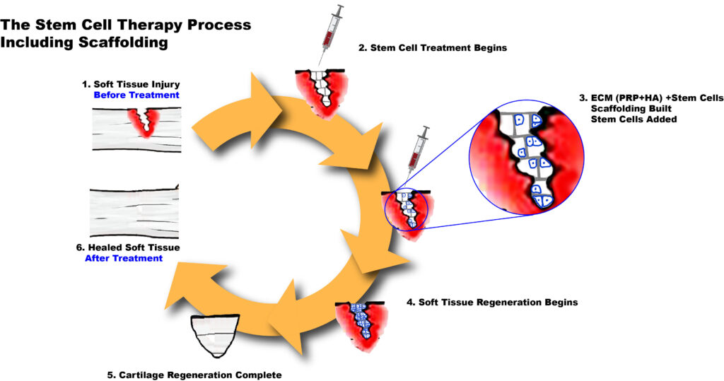 STEM-CELL-with-numbers-1024x539